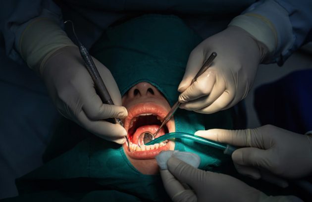 oral Surgery