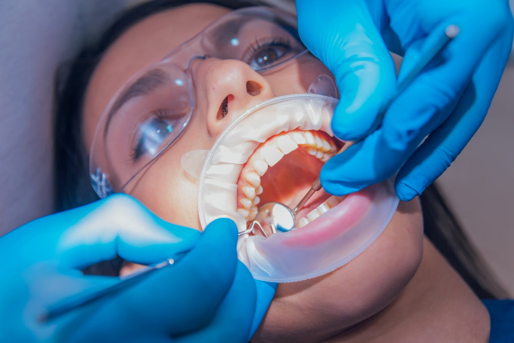 Root Canal Treatment - Dr Sadiq Sharaf Dental Center
