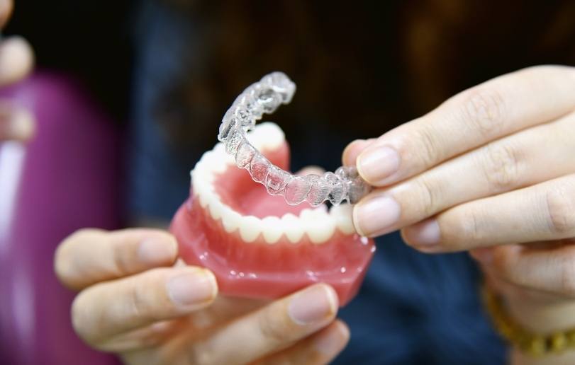 invisalign orthodontic - Dr Sadiq Sharaf Dental Center